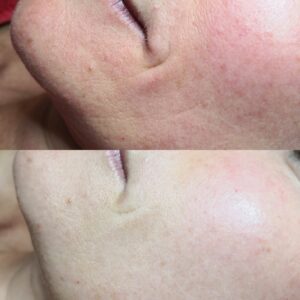Before and after image showcasing the transformative effects of PQ Age Evolution skincare product: on the left, dull skin with visible wrinkles and age spots; on the right, radiant, youthful skin with reduced wrinkles and improved firmness